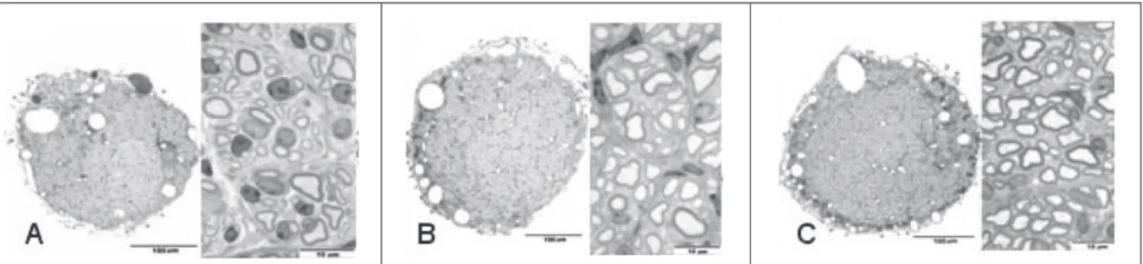 Figura 2 – A) microfotografia de corte histológico do nervo ciático de um camundongo do grupo colágeno