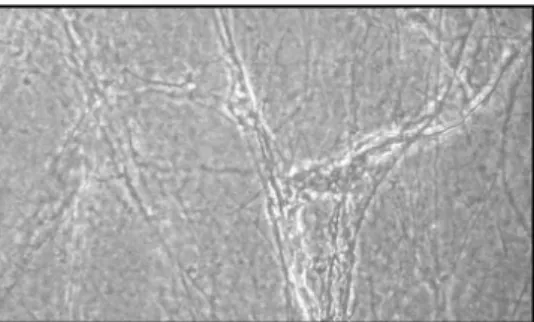 Figura  6  -  Microfotografia    do  Gel  Carpet  com  plaquetas  descongeladas.  Aumento 10x.
