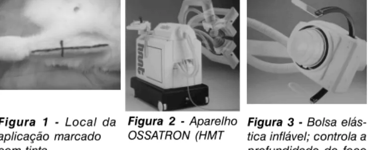 Figura 2 - Aparelho OSSATRON (HMT