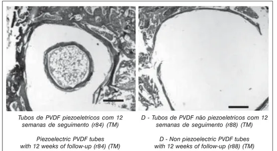Figura 3 - Imagens da microscopia eletrônica de varredura por retroespalhamento da extremidade distal do fêmur, com tubos piezelétricos (direita) e não piezelétricos (esquerda), após 12 semanas de seguimento