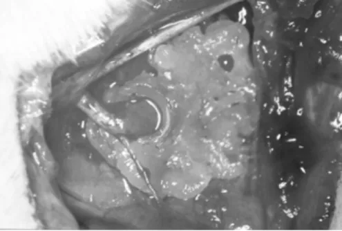 Figure 1 - Sciatic nerve showing its sural, peroneal and tibial ramifications.