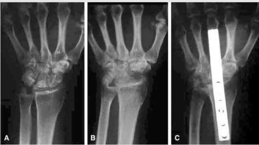 Figure 1 - Graphic presenting the results of comparative