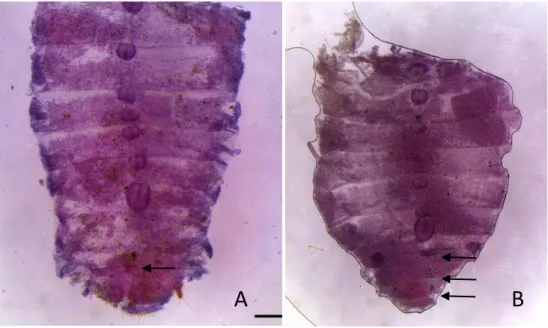 Figura 9. Cortes abdominais de soldados de  Inquilinitermes fur em carmim clorídrico para  determinação de sexo: A) macho e B) fêmea