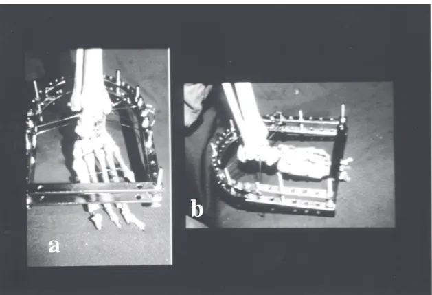 Fig. 2a - Assembly of seen Fixador of front 2b - Assembly fixador seen lateral