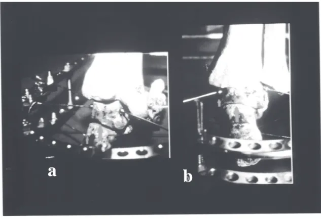 Fig 3a - Seen subsequent assembly fixador. Larger