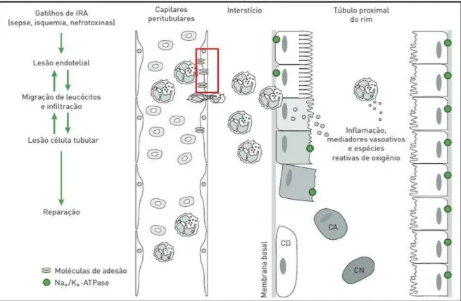 FIGURA 7  –  Lesão endotelial na lesão renal aguda 