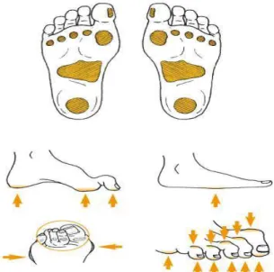 Figura 2: Áreas de risco de ulceração nos pés. 