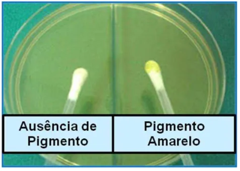 Figura  5-  Prova  de  produção  de  pigmento  amarelo  para  a  identificação  de  espécies  de  Enterococcus.