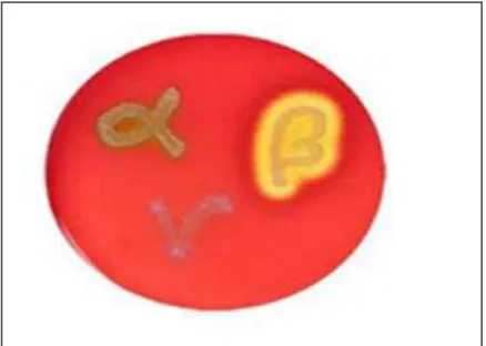 Figura 6- Hemólises α, β ou Ƴ observadas em ágar sangue para a identificação de espécies  dos gêneros Streptococcus e Enterococcus
