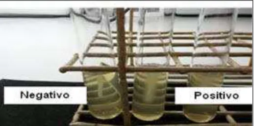 Figura  8-  Teste  de  motilidade  para  a  identificação  fenotípica  de  espécies  dos  gêneros  Streptococcus e Enterococcus