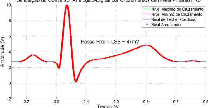 FIGURA 15 – ECG AMOSTRADO COM PASSO DE QUANTIZAÇÃO FIXO DE 47  MILIVOLTS 