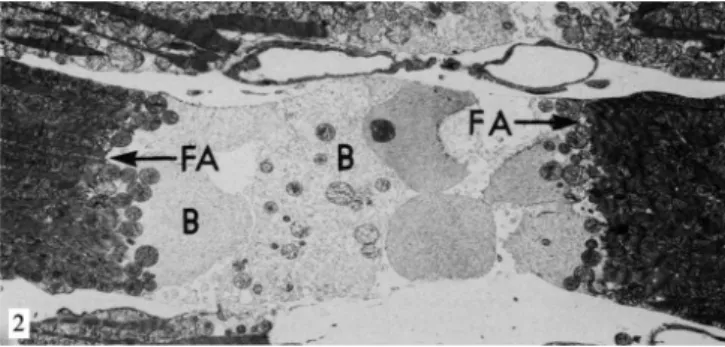Fig. 2 - Eletromicrografia de coração de rato após 5 minutos em  perfusão sem cálcio, seguido de 15 minutos com adição de DNP ao  primeiro perfusato