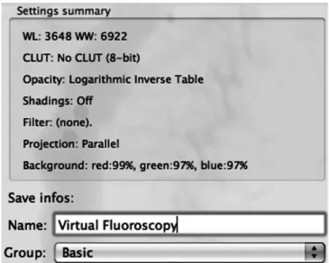 Fig. 3 - Configuração manual do preset 3D no OsiriX MD, nomeado  como Virtual Fluoroscopy