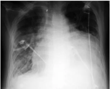 Fig. 1 – Radiografia de tórax