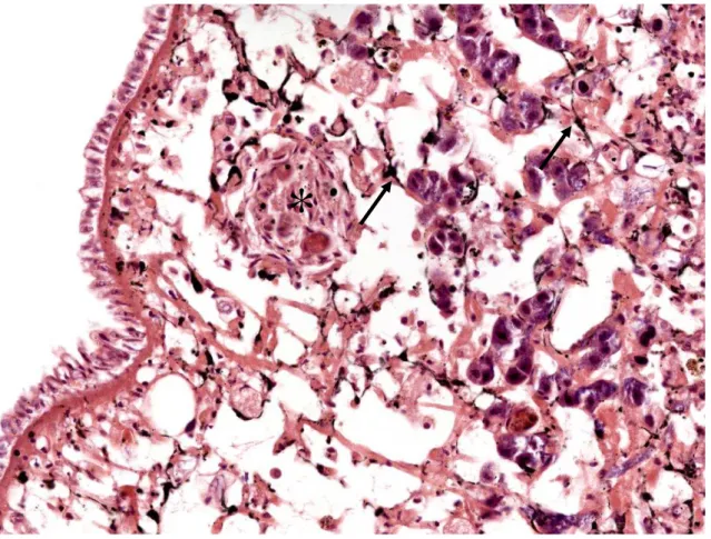 Fig. 14. Região cefalopodal com presença de granuloma bacteriano (*) e células dendríticas (setas) em molusco  com 10 dias de infecção