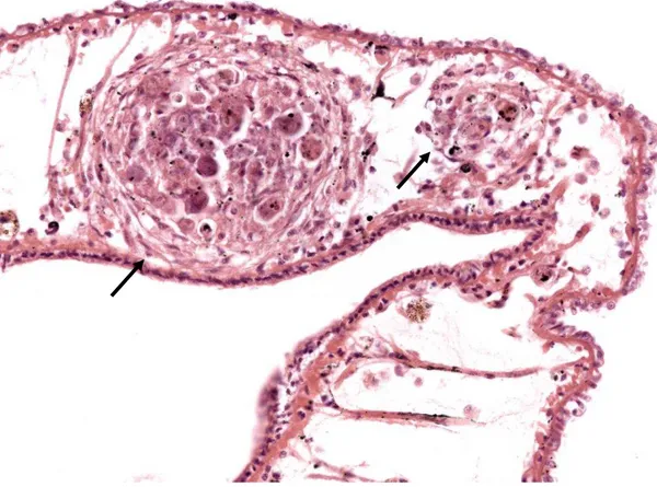 Fig. 15. Granulomas bacterianos (setas) na região do colar do manto em molusco com 10 dias de infecção
