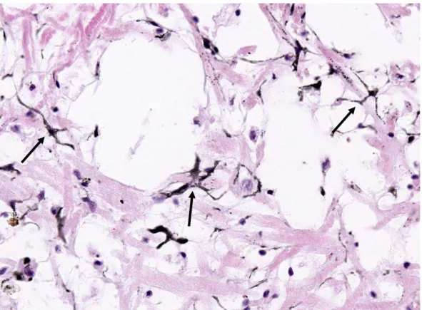 Fig. 17: Presença de células dendríticas (setas) na região cefalopodal de molusco com 10 dias de infecção