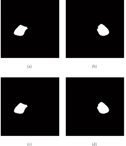 Figura 4.4: opera¸c˜oes morfol´ogicas (a) fechamento aplicado no pulm˜ao esquerdo, (b) fechamento aplicado no pulm˜ao direito, (c) eros˜ao aplicada no pulm˜ao esquerdo e