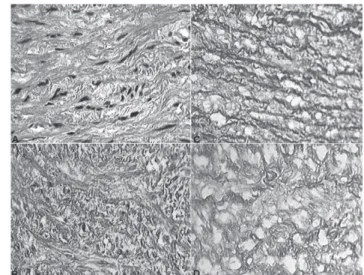 Fig. 1 - À esquerda: análise qualitativa da matriz extracelular de condutos pulmonares submetidos a processo de descelularização