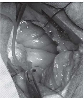 Fig. 1 - Janela pericárdica realizada para injeção intramiocárdica de VEGF 165