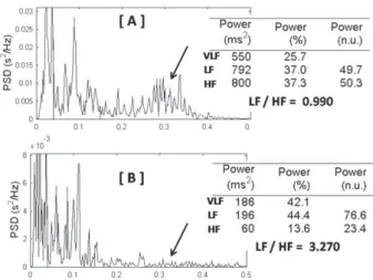 Fig. 3 – Análise espectral de frequências (Fast Fourier Transform) de um adulto jovem normal (A) e de um recém-nascido normal (B)