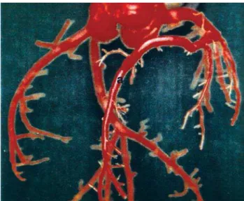 Fig. 1 - Origem das artérias coronárias - a: artéria coronária direita; b: artéria coronária esquerda