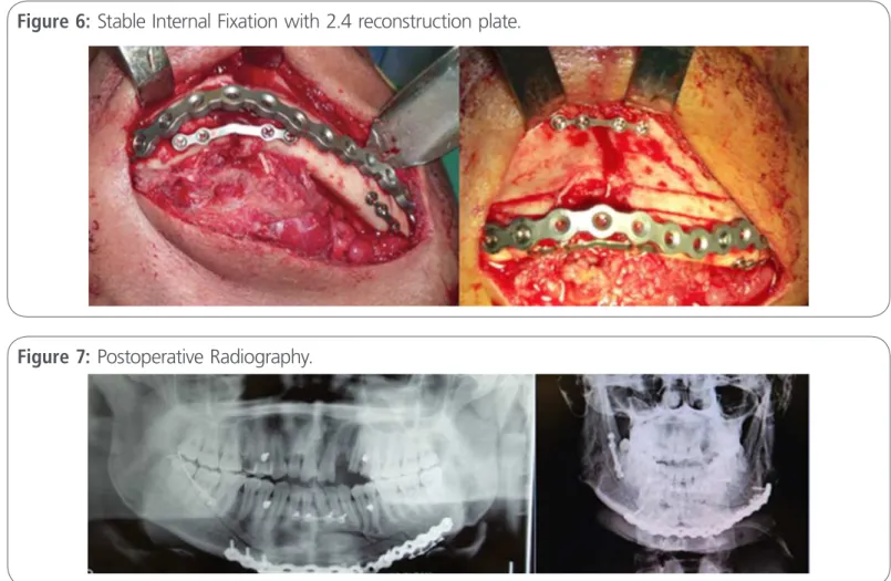 Figure 7: Postoperative Radiography.