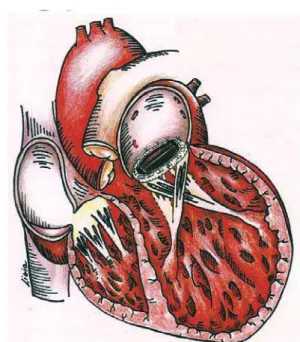 Fig. 3 - Imagem ecocardiográfica pós-operatória mostrando o cruzamento dos músculos papilares.
