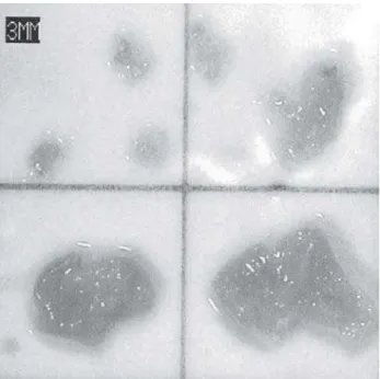Fig. 2 - Material embólico capturado no filtro intra-aórtico do paciente