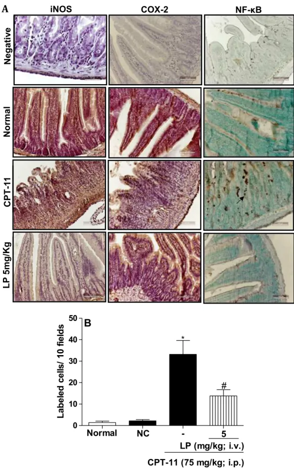 Figure 5. Photomicrographs of sections show immunoexpression of iNOS, COX-2, and NF-κB on the irinotecan-induced intestinal mucositis (A)