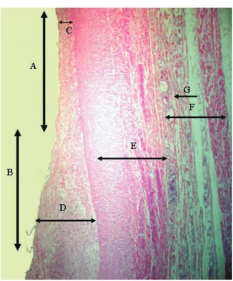 Tabela 1.  Tamanho médio da parede da aorta, com e sem stent