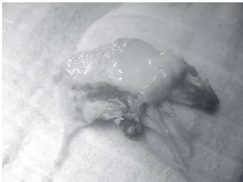 Fig. 1 - Cúspide anterior da valva mitral com vegetações.
