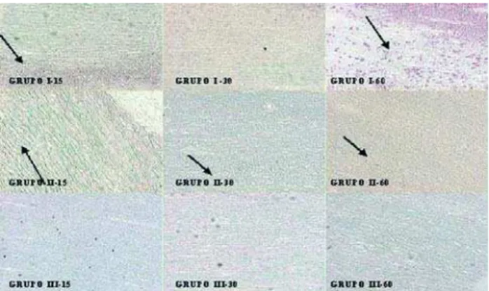 Fig. 6 - Análise morfométrica da calcificação dos condutos, nos três períodos estudados