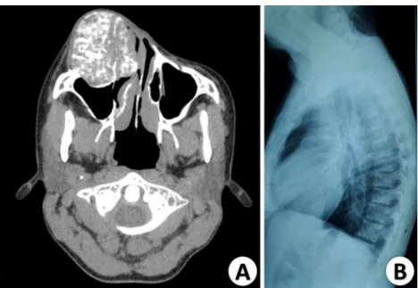 Fig. 4 Once the lesion was exposed during surgery, it revealed bleeding aspect (a).