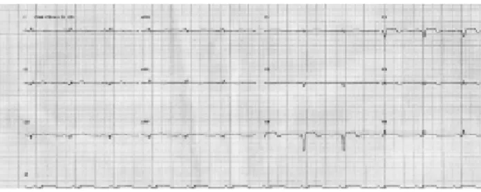 Fig. 1C - 1º Pós-operatório