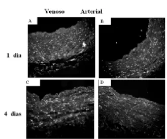 Fig. 4 - Coloração com Hoechst 33258 de veia safena cultivada por um (A,B) e quatro (C,D) dias, em regime hemodinâmico venoso (A,C) e arterial (B,D) (aumento de 100X).Observa-se manutenção da densidade celular nas veias safenas do grupo sob regime venoso (