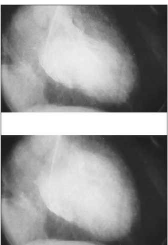 Fig. 1 – Fotos da ventriculografia do coração em sístole e diástole.