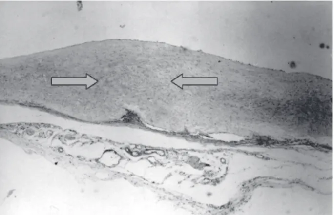 Fig. 7 - Fotomicrografia mostrando corte longitudinal da