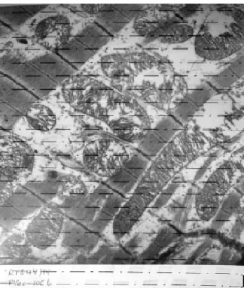 Fig. 1 - Imagem de uma micrografia eletrônica de um fragmento de miocárdio obtido do ápice do ventrículo esquerdo com aumento de 23.100 vezes, com a aplicação do sistema teste utilizado.com solução cardioplégica sangüínea