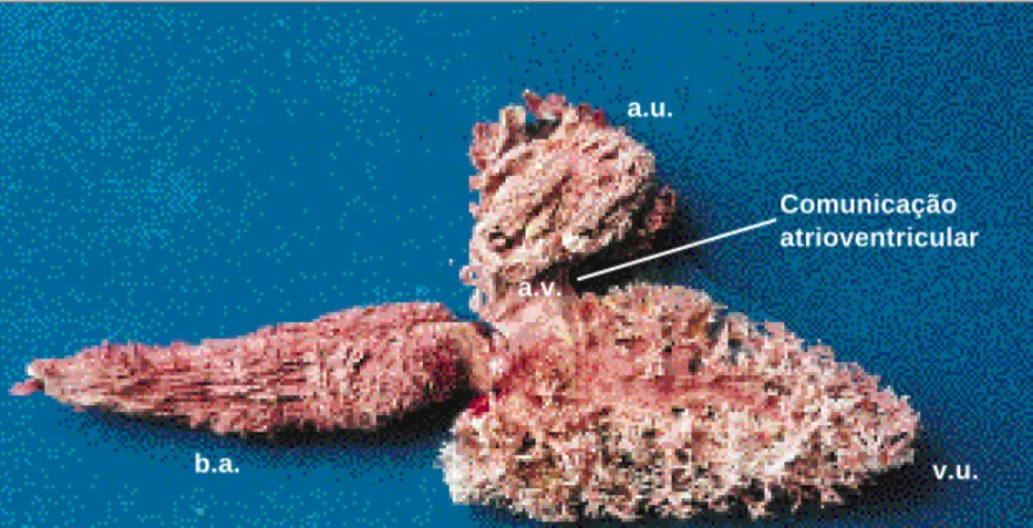 Fig. 1 - Peixe arabaiana (Elagatis bipinnulatus) - Vista ventral do coração, apresentando bulbo arterioso (b.a.) completo, ventrículo único (v.u.), comunicação atrioventricular (a.v.) e átrio único (a.u.)