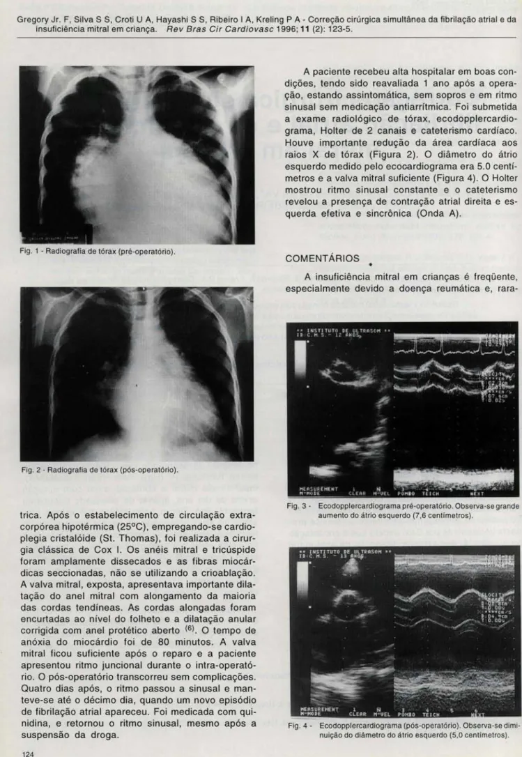 Fig. 1 .  Radiografi a de tórax  (pré-ope rató ri o) . 