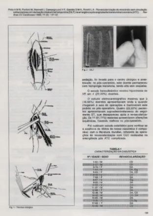 TABELA  j  CARACTERIZAÇÃO DA CASUISTlCA  REVASCUlARIZAÇÃO  1.-6311.1  ~  g;  ~ A..IDg ----&#34;  5·63  I  F  DA,  CD  ~-~F  - F  -r~~ ' ~~  - ~  -