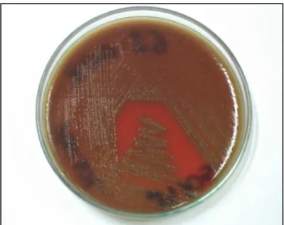 Figura  7.  Crescimento  em  ágar  sangue  de  colônias  planas com alfa hemólise ao seu redor, características de  S