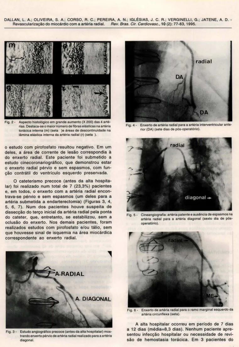 Fig . 2 - Aspecto histológico em grande aumento (X 200) das 4 arté- arté-rias . Destaca-se o maior número de fibras elásticas na artéria  torácica interna (m)  (seta  )e  áreas de descontinuidade na  lâmina elástica interna da artéria radial  (r)  (seta  )