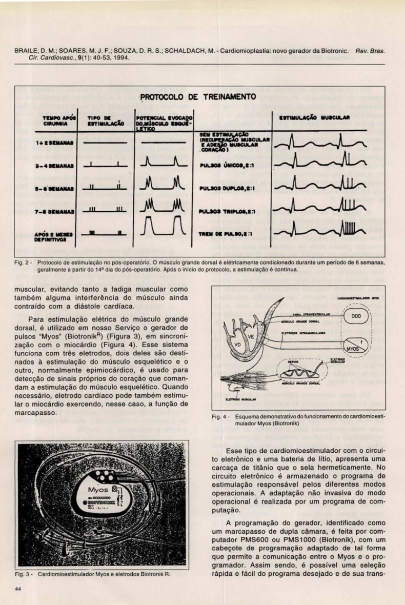 Fig . 2 - Protocolo de  estimulação no  pós-operatório. O músculo grande dorsal é elétricamente condicionado durante um  período de 6 semanas,  geralmente a partir do  14·  dia do pós-operatório 