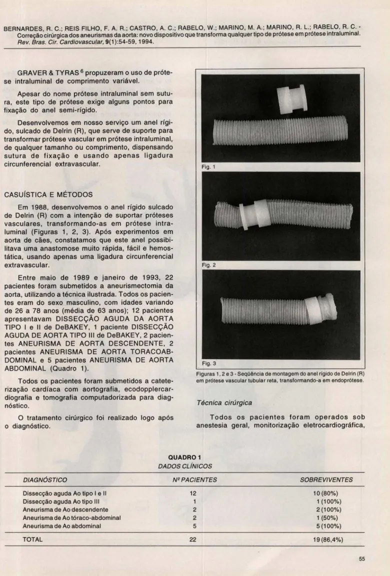 Figu ras 1,2 e 3 - Seqü ência de montag em do an el rígido de Delri n (R)  em prótese vascular tubu lar reta , transform ando-a em  endoprótese 