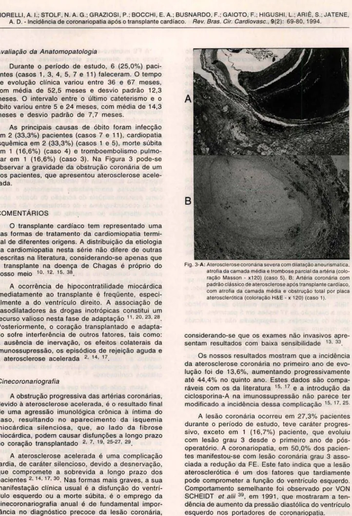 Fig . 3-A : Ate rosc lerose coronária seve ra com dilatação aneurismatica.  at rofia da ca mada média e tro mbose parc ial da a rtéria  (colo-ração  Masso n  - x120)  (caso  5)