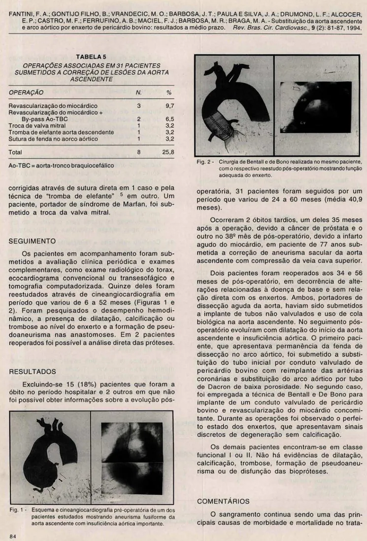 Fig . 2 - Cirurgia de Sentall e de Sono realizada no mesmo paciente,  co m o respectivo reestudo pós-operatório mostrando função  adequada do enxerto