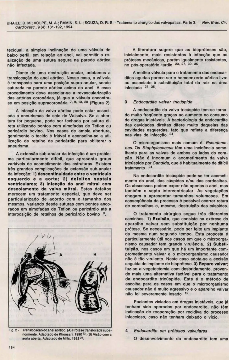 Fig.  2·  Translocação do anel aórtico. (A) Prótese translocada supe- supe-riormente. Adaptado de Khonsari , 1990 22 