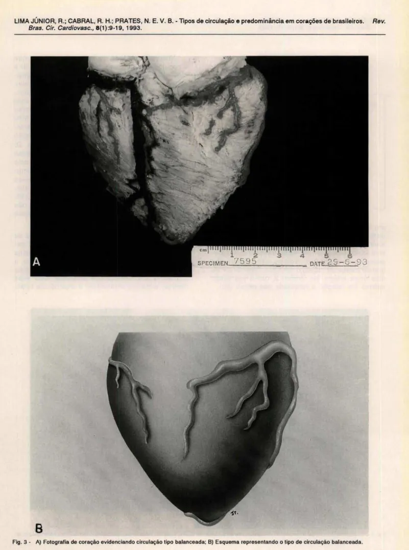 Fig.  3  - A)  Fotografia de  coração evidenciando circulação tipo balanceada; B)  Esquema representando  o tipo de circulação balanceada